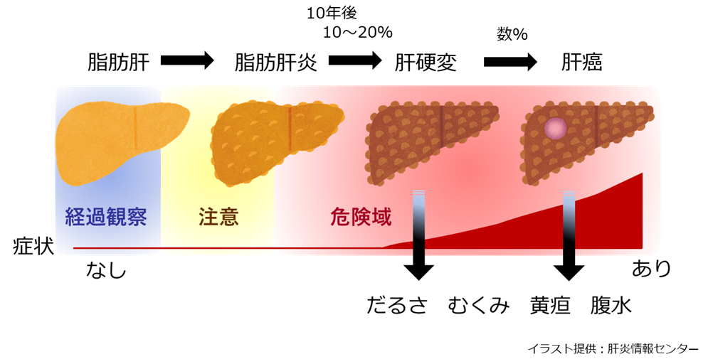 熊本大学病院　肝疾患センター図
